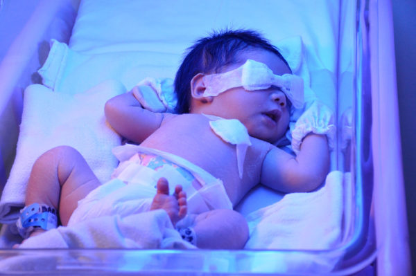 Анализ крови на билирубин у новорожденных