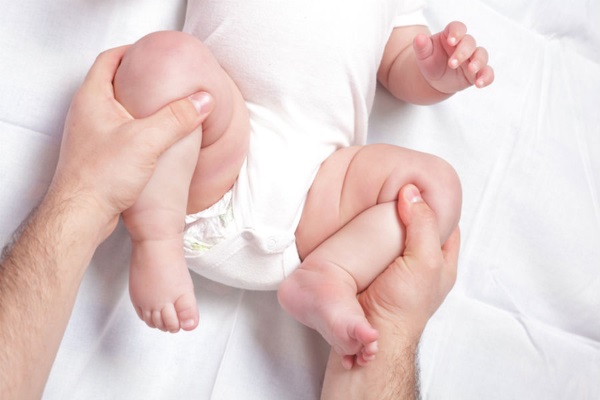 Причины дисплазии тазобедренных суставов у новорожденных